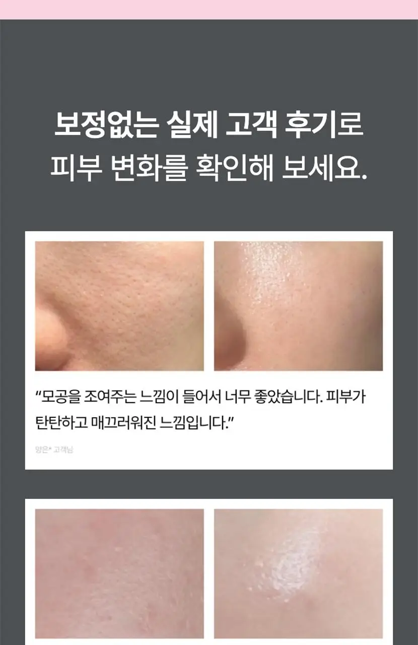 [단독기획/모공탄력] 셀리맥스 더 비타 A 레티날 샷 타이트닝 부스터 15ml 기획(+3ml) 상세페이지 24